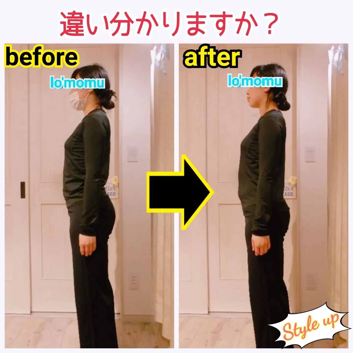 【腰痛卒業◎】骨盤の歪み,反り腰,腰痛の改善施術 1回